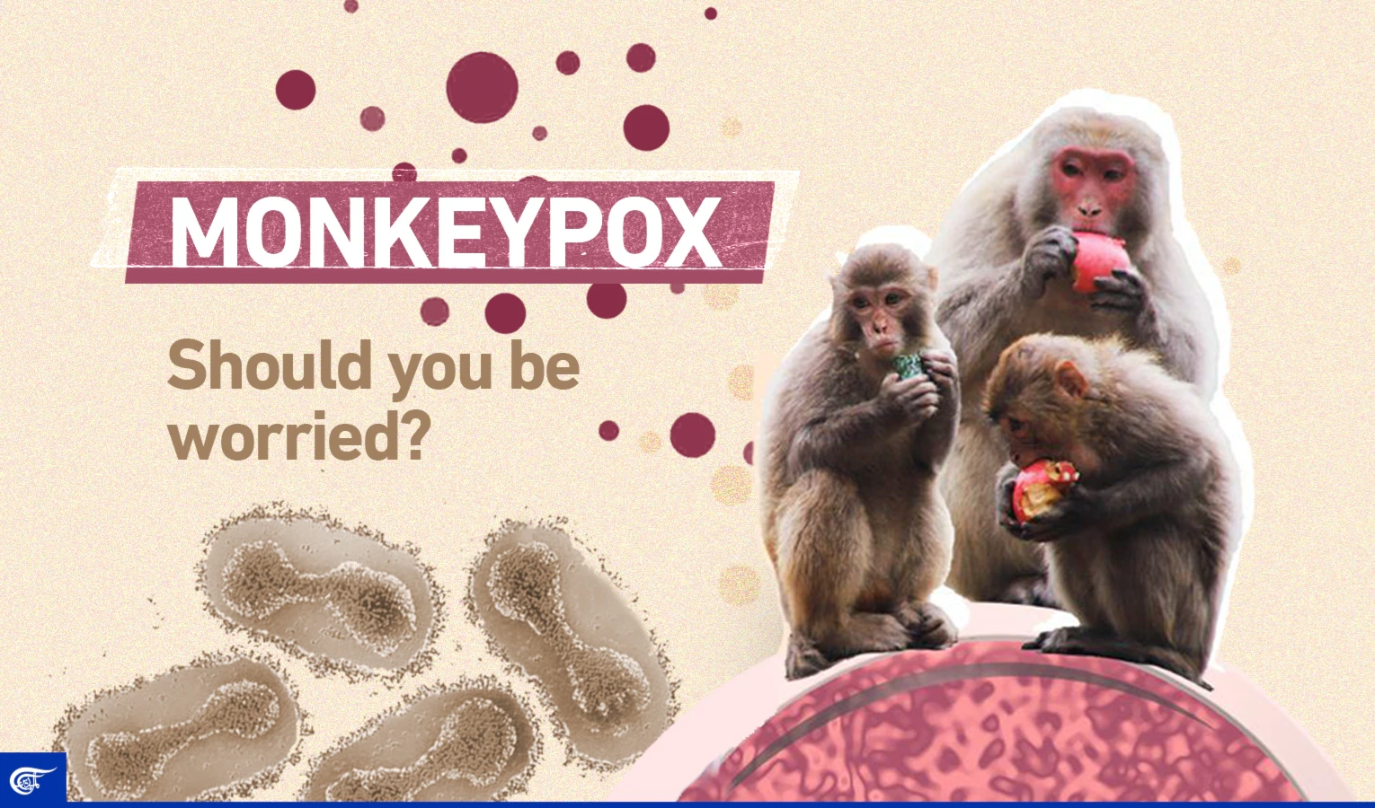 Monkeypox: Should you be worried?