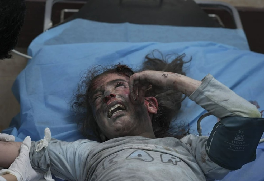 A Palestinian child severely wounded in an Israeli bombardment of the Gaza strip screams out of pain at a hospital, south of the Gaza strip on October 21. (AP)