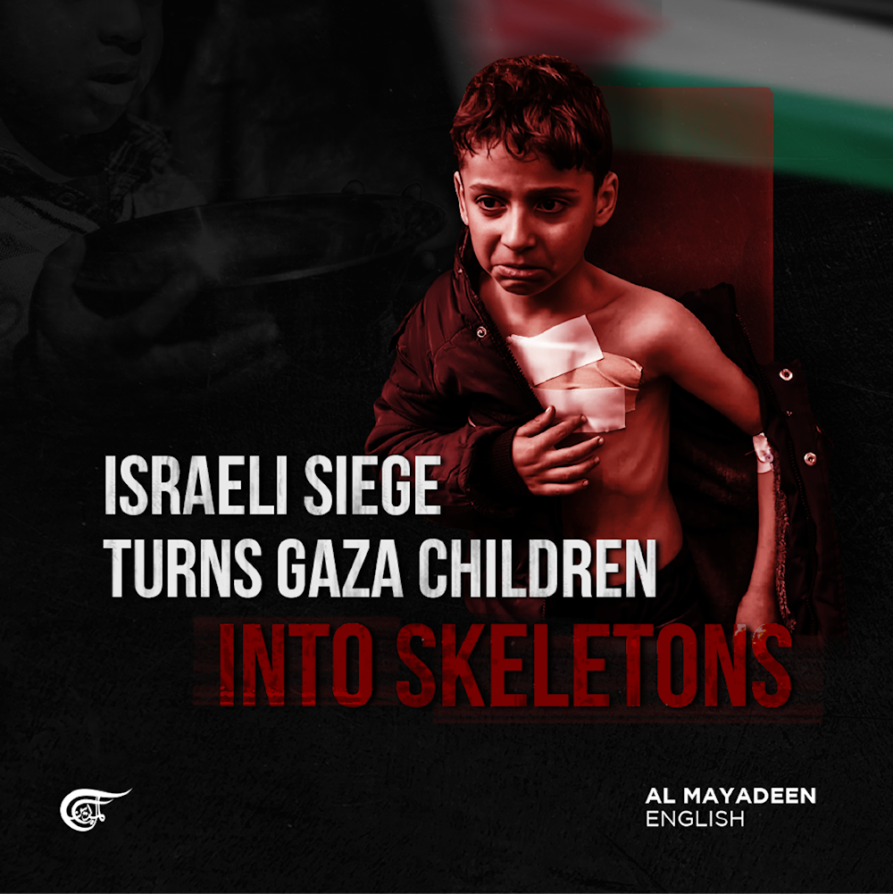Israeli siege turns Gaza children into skeletons