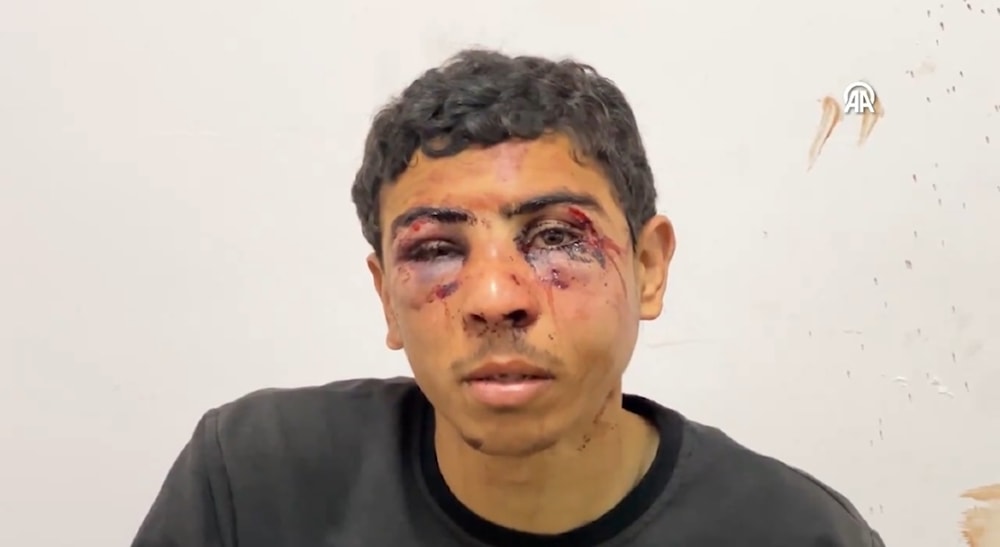 Ramadan Shamlakh, 21 years old, was beaten and tortured by Israeli soldiers in Gaza City (Photo: Anadolu Agency)