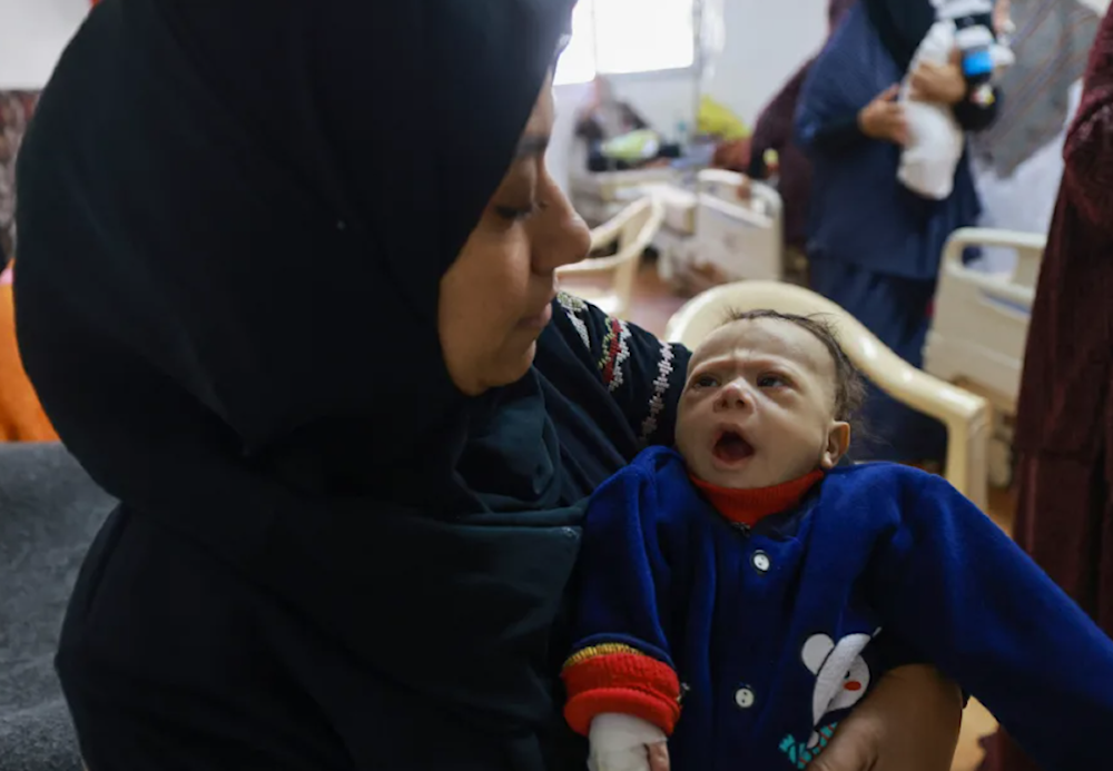 Four Palestinians die of malnutrition and dehydration in Gaza