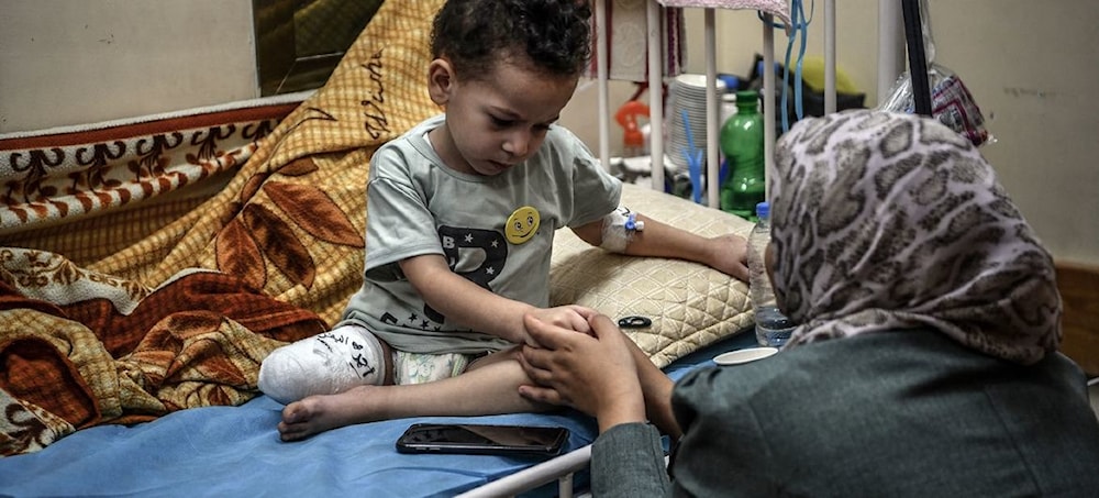 Abed Zaqout is a 3-year-old boy, whose house was bombed, recovering in Nasser hospital after the amputation of part of his right leg on December 2023. (UNICEF) 