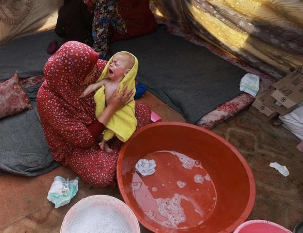  A woman dries a baby after bathing the child, at a camp for displaced Palestinians in Rafah, in the southern Gaza Strip. (AFP)