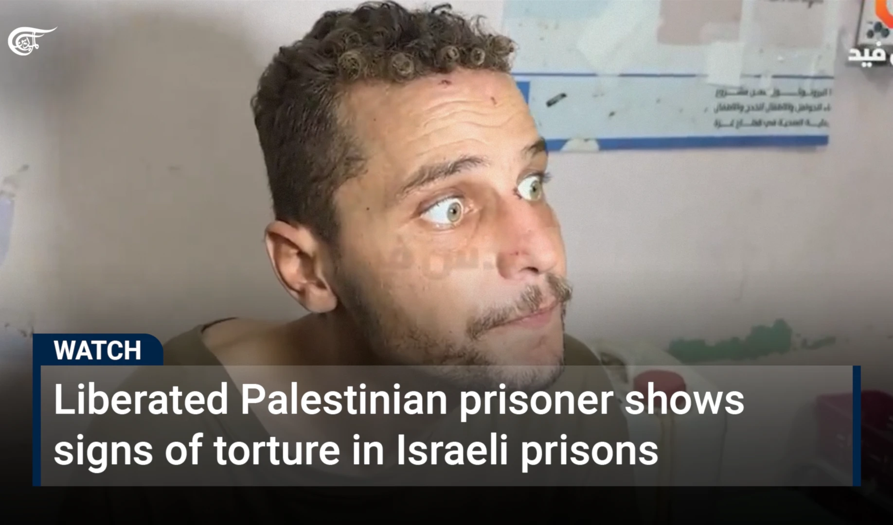Liberated Palestinian prisoner shows signs of severe torture in Israeli prisons