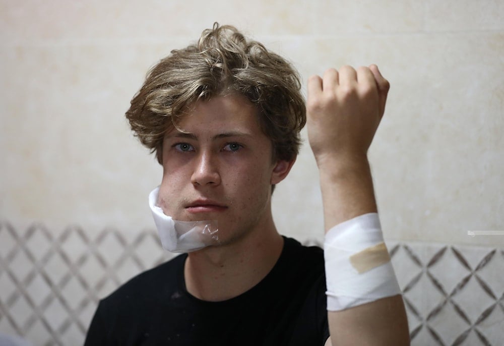 David Hummel, an American-German, injured after being attacked by Israeli settlers, July 21, 2024 (Social Media)