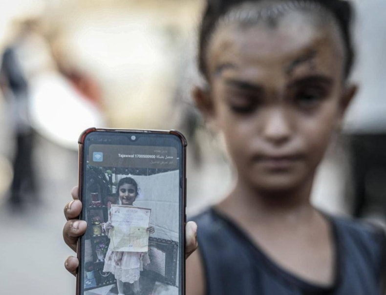  Palestinian child Sila, 7 years old, was injured while sheltering in a school in Gaza. (@MuhammadSmiry / X)