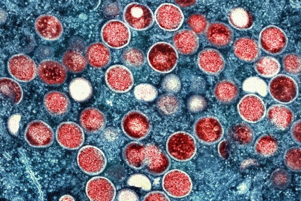 The colorized electron microscope image provided by the National Institute of Allergy and Infections Diseases shows Mpox particles, red, found within an infected cell. (AP)