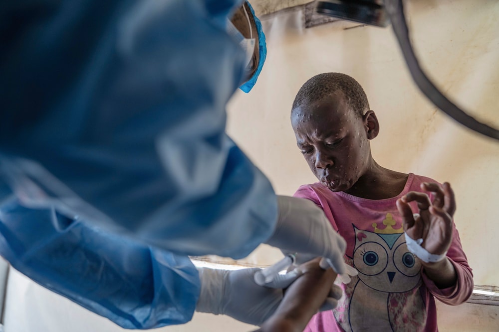 A health worker attends to a mpox patient, at a treatment centre in Munigi, eastern Congo, August 19, 2024. (AP)