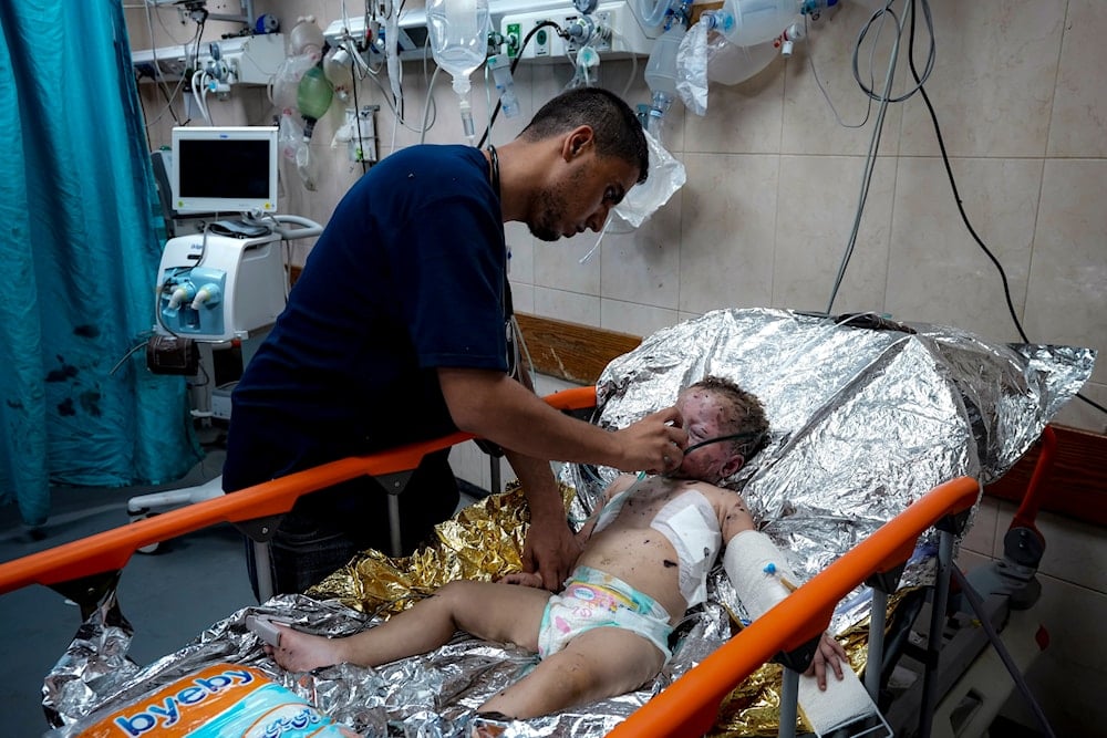 Palestinian Child Siwar Abdel-Hadi, 2, wounded in the Israeli bombardment of the Gaza Strip, receives medical treatment at a hospital in Deir al-Balah, on July 24, 2024. (AP)