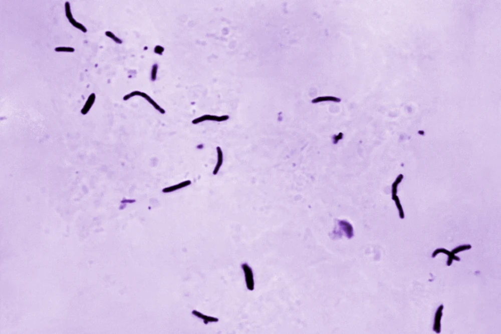 This 1966 microscope photo provided by the US Centers for Disease Control and Prevention shows Mycobacterium tuberculosis bacilli, the organism responsible for causing the disease tuberculosis, (CDC via AP)