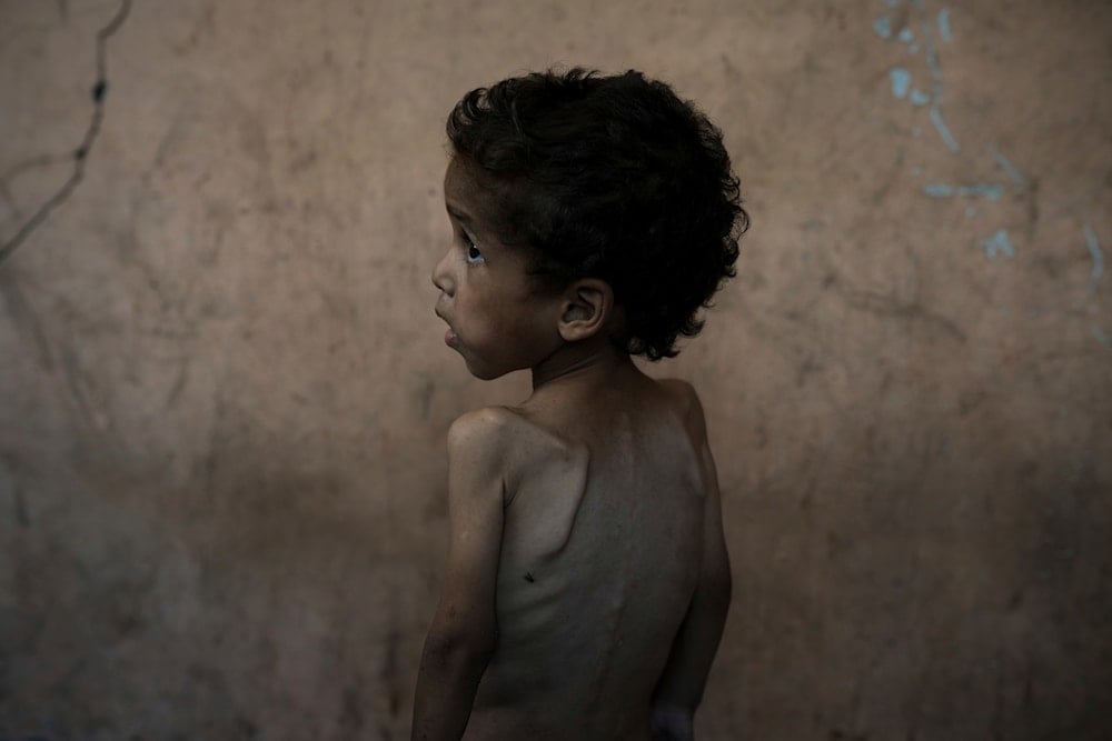 ‘They are wasting away’: Gaza’s children face mass starvation