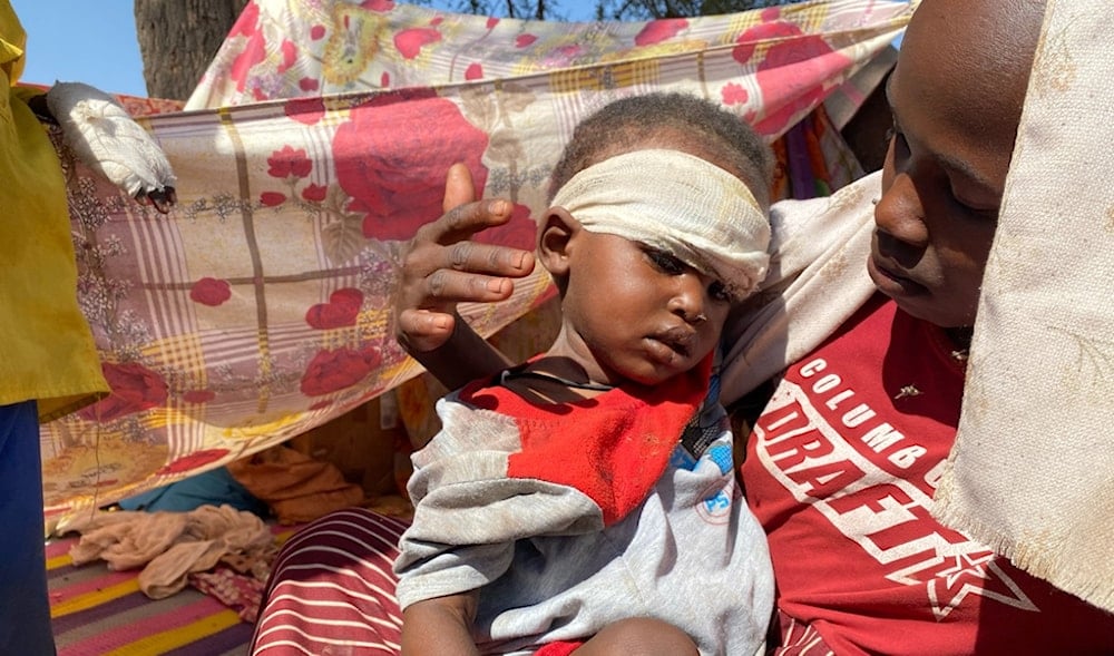 A Sudanese child who fled el-Fasher city with family receives treatment at a camp in Tawila, Sudan, Sunday, Nov. 2, 2025. (AP)