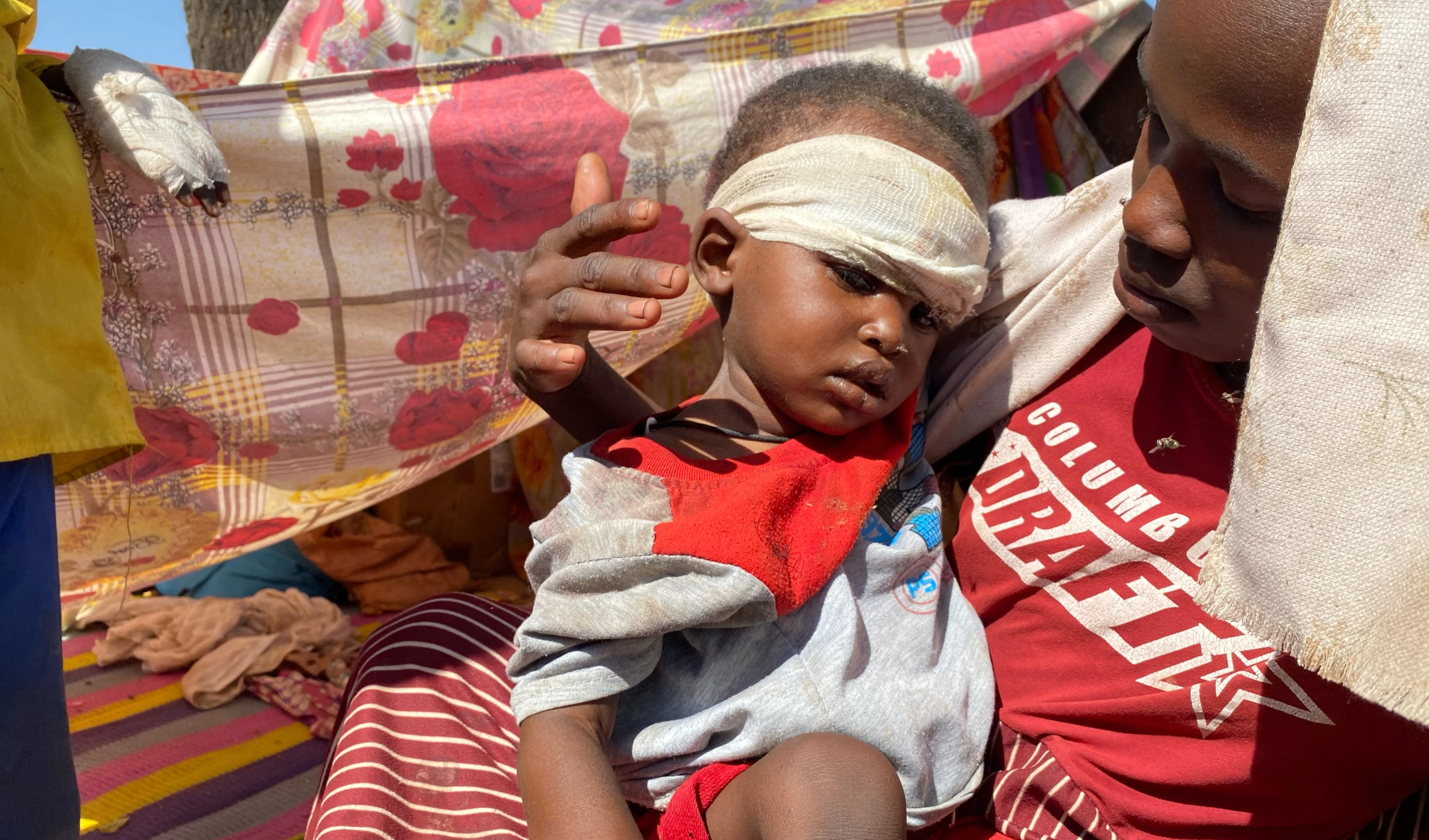 A Sudanese child who fled E -Fasher city with family after Sudan's paramilitary forces killed hundreds of people in the western Darfur region, receives treatment at a camp in Tawila, Sudan, Sunday, Nov. 2, 2025 (AP)