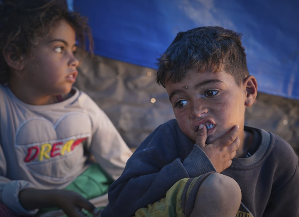 Fifty-seven Gazan children died from malnutrition since March: WHO