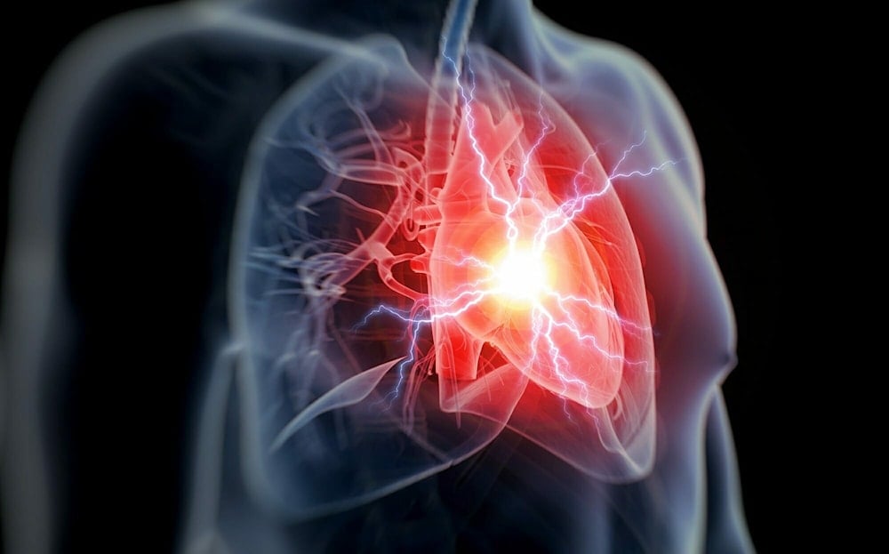 An illustrated image of a heart appears under X-ray in this undated photo (photocredit: AFP)