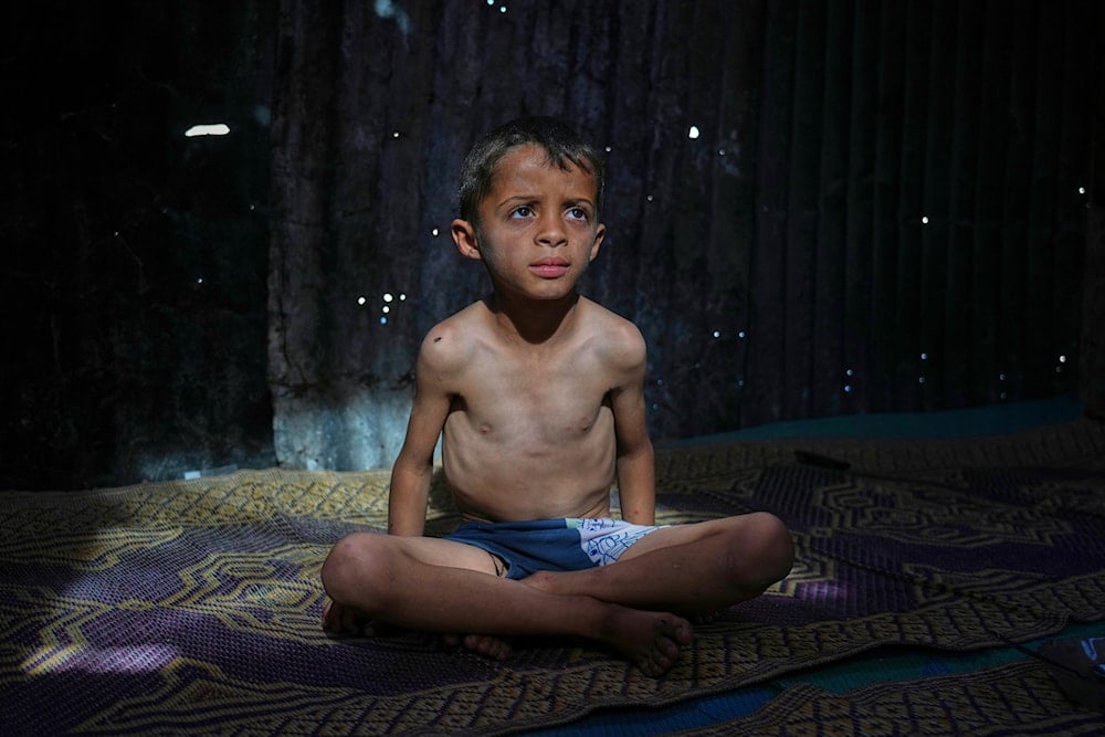 Child malnutrition in Gaza surges amid prolonged starvation: AP