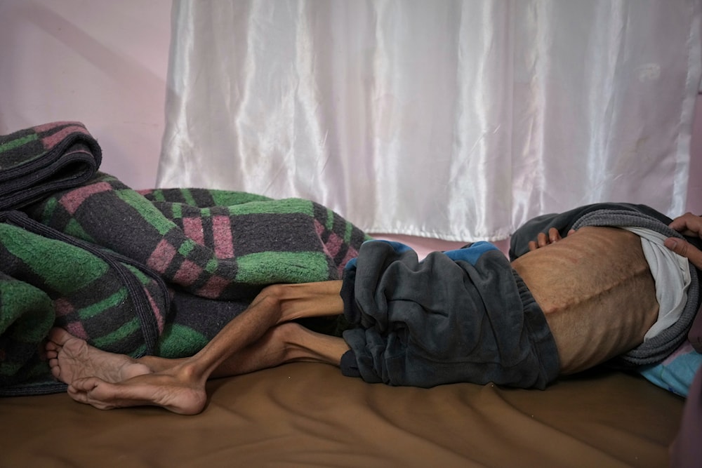 Gaza health ministry sounds alarm on famine and child deaths
