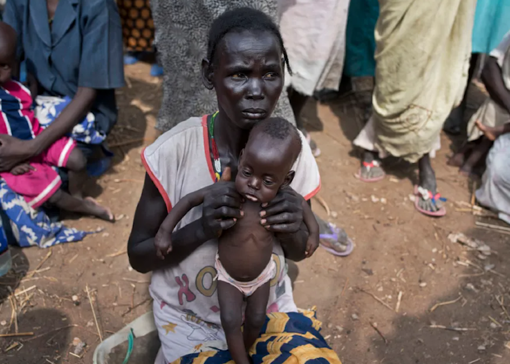 South Sudan clashes block aid to 60,000 malnourished children