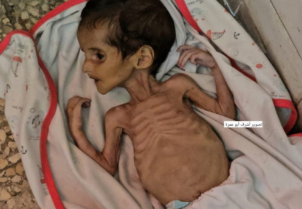 Jory al Masri, a little Palestinian baby from Gaza, has passed away due to the lack of formula and severe malnutrition. (Credit: Ashraf Abu-Omra)
