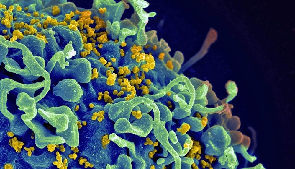 An illustration of the HIV virus (Credit: National Cancer Institute/Unsplash)