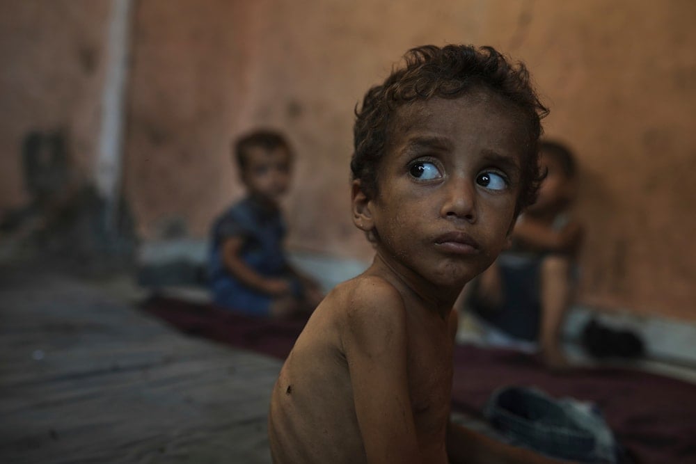 MSF: One in four Gaza children under 5 show signs of starvation