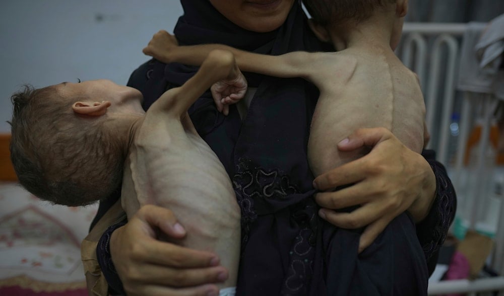 Famine claims the lives of 5 Palestinians in the past 24 hours