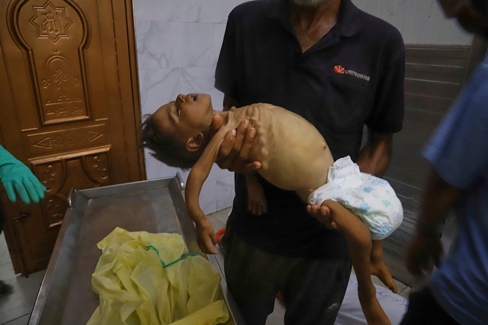 Adnan Al-Najjar carries the body of 5-year-old grandson Jamal al-Najjar for his funeral after he died at Nasser Hospital in Khan Younis, southern Gaza Strip, on August 12, 2025. 