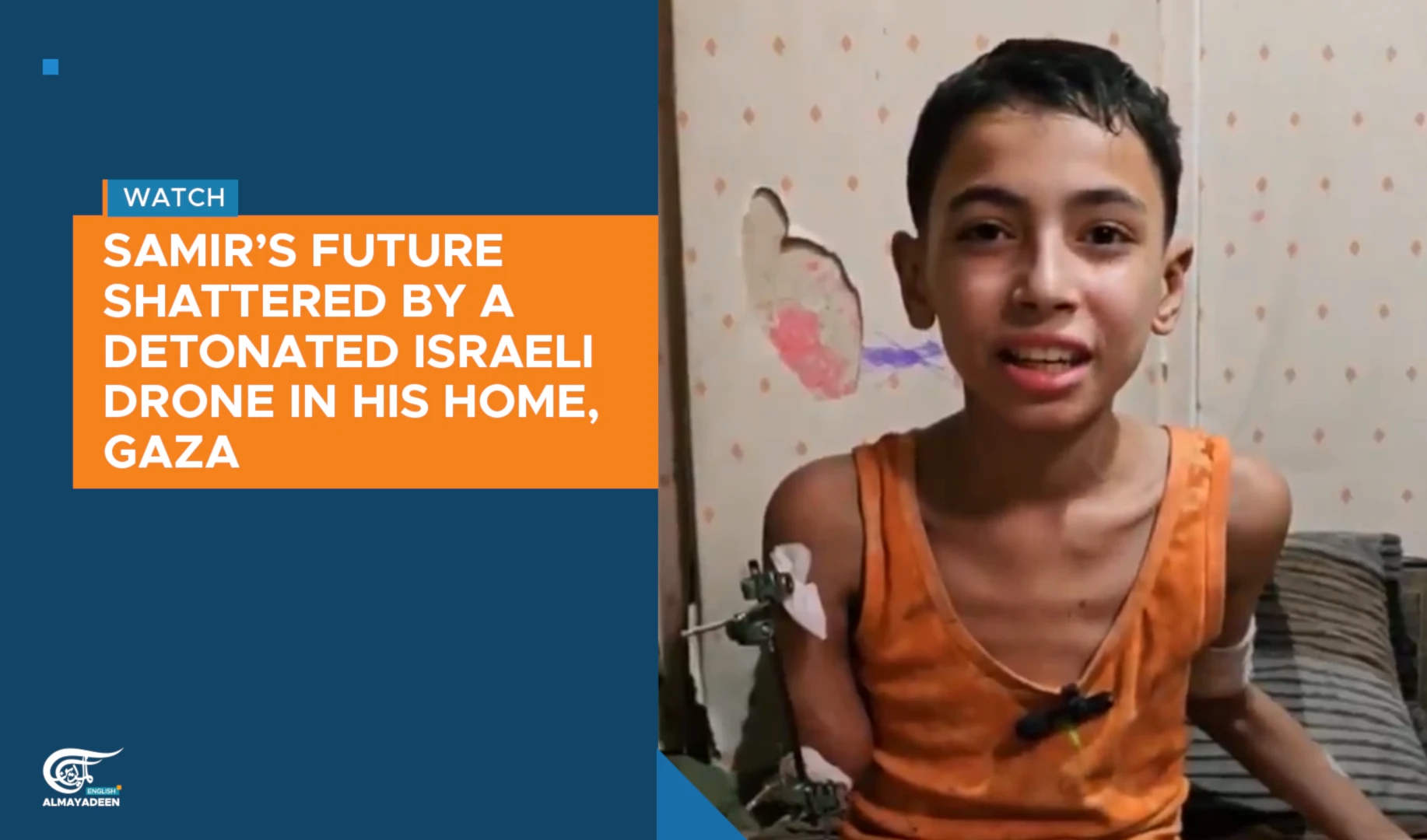 Samir’s future shattered by a detonated Israeli drone in his home, Gaza