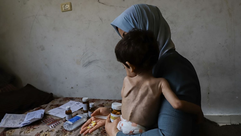 The mother of Amjed Al-Qanooa, 3, who suffers from severe malnutrition, shows the pills prescribed for her son in the Jabalia camp in northern Gaza on June 9, 2024. (Abood Abusalama/AFP/Middle East Images/Getty Images)