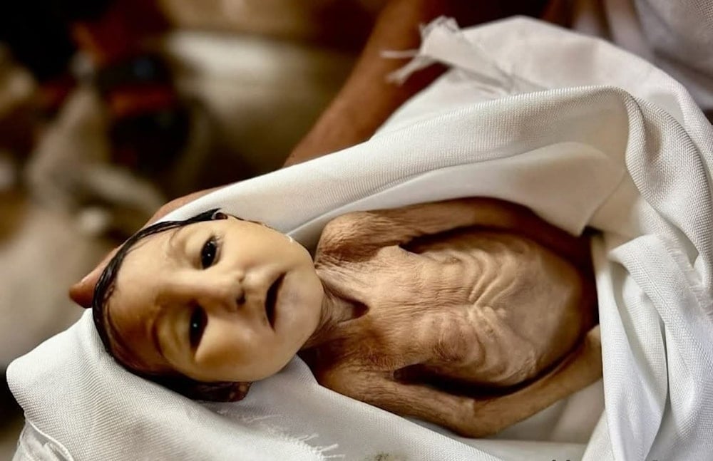 The five-month-old infant, Ghadir Brika, passed away in Khan Younis, southern Gaza as a result of starvation and malnutrition. (Photo credit: Amro Tabash)