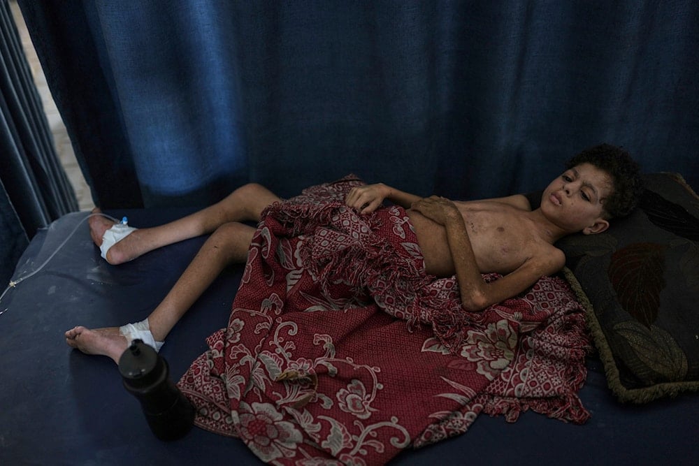 Starvation deepens in Gaza as Israeli strikes continue