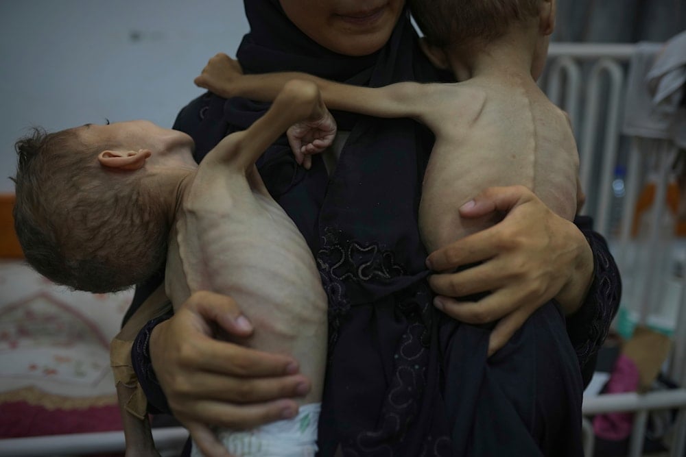 Omniya Mahra, holds shirtless for a photo her sons Oday, 4, left, and Mohammed, 3, who suffer from malnutrition and a genetic nerve disorder, at the Friends of the Patient Hospital in Gaza City, Tuesday, July 29, 2025.(AP)