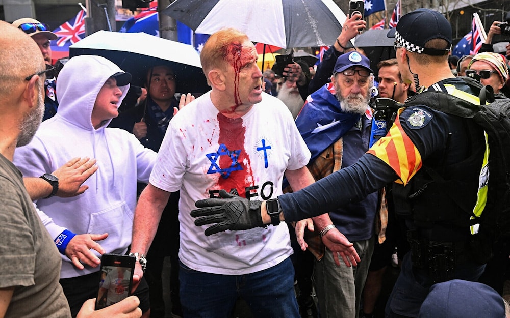 An injured protester reacts during a 